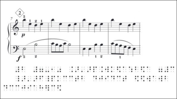 Musiknoten in Braille (SBS)